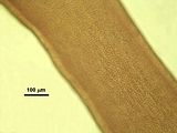 8 – Cellule corticali in visione superficiale